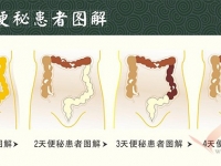 便秘是许多老年人顽症，空位按摩可有效缓解症状
